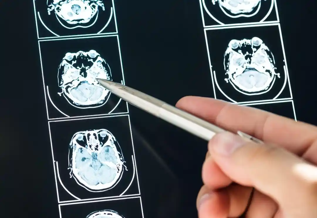 Signs of a brain injury