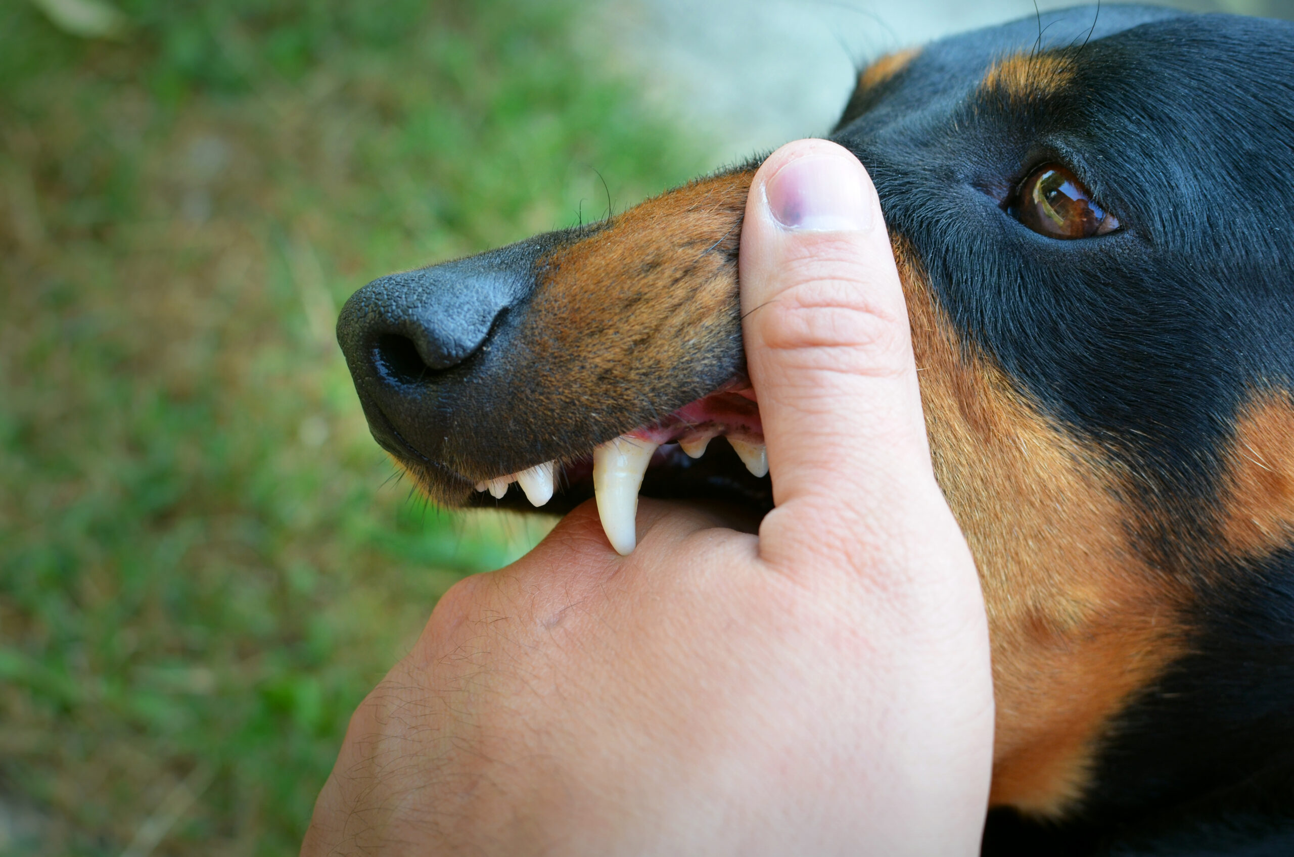 Can I Sue for a Dog Bite Injury? Who’s Legally Responsible?